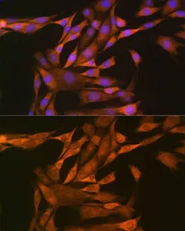 Anti-Thioredoxin antibody used in Immunocytochemistry/ Immunofluorescence (ICC/IF). GTX64390