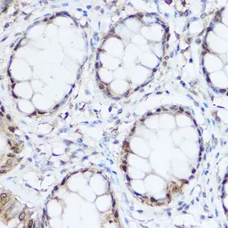 Anti-Thioredoxin antibody used in IHC (Paraffin sections) (IHC-P). GTX64390
