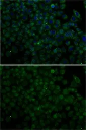 Anti-Angiogenin antibody used in Immunocytochemistry/ Immunofluorescence (ICC/IF). GTX64392