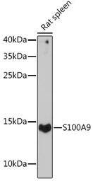 Anti-S100A9 antibody used in Western Blot (WB). GTX64397