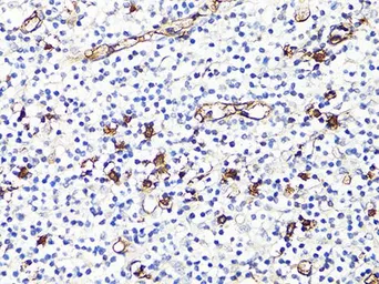 Anti-S100A9 antibody used in IHC (Paraffin sections) (IHC-P). GTX64397
