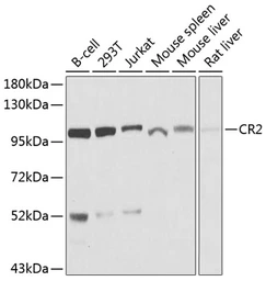Anti-CD21 antibody used in Western Blot (WB). GTX64400