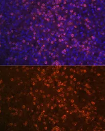 Anti-CD21 antibody used in IHC (Paraffin sections) (IHC-P). GTX64400