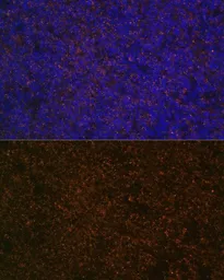 Anti-CD21 antibody used in IHC (Paraffin sections) (IHC-P). GTX64400