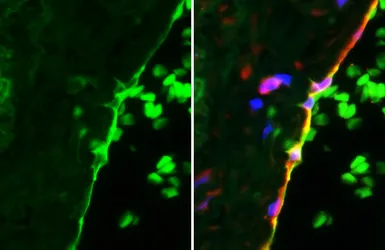 Anti-ICAM1 / CD54 antibody [HL4447] used in IHC (Paraffin sections) (IHC-P). GTX644012