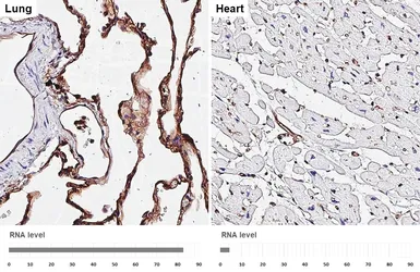 Anti-ICAM1 / CD54 antibody [HL4447] used in IHC (Paraffin sections) (IHC-P). GTX644012