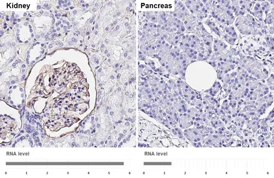 Anti-ICAM1 / CD54 antibody [HL4447] used in IHC (Paraffin sections) (IHC-P). GTX644012