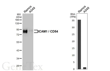 Anti-ICAM1 / CD54 antibody [HL4447] used in Western Blot (WB). GTX644012