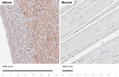 Anti-SLC38A1 antibody [HL4453] used in IHC (Paraffin sections) (IHC-P). GTX644018