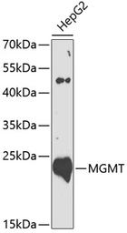 Anti-MGMT antibody used in Western Blot (WB). GTX64402