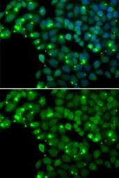 Anti-MGMT antibody used in Immunocytochemistry/ Immunofluorescence (ICC/IF). GTX64402