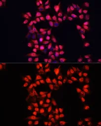 Anti-ADAM10 antibody used in Immunocytochemistry/ Immunofluorescence (ICC/IF). GTX64403