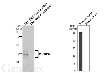 Anti-MRGPRF antibody [HL4466] used in Western Blot (WB). GTX644031