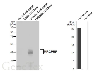 Anti-MRGPRF antibody [HL4466] used in Western Blot (WB). GTX644031