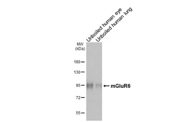 Anti-mGluR6 antibody [HL4469] used in Western Blot (WB). GTX644034