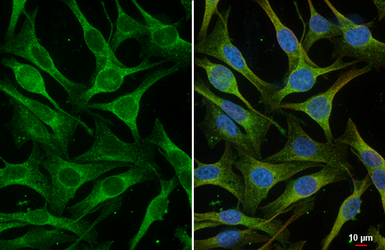 Anti-APC antibody [HL4473] used in Immunocytochemistry/ Immunofluorescence (ICC/IF). GTX644038