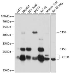 Anti-Cathepsin B antibody used in Western Blot (WB). GTX64404