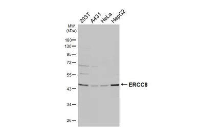Anti-ERCC8 antibody [HL4475] used in Western Blot (WB). GTX644040
