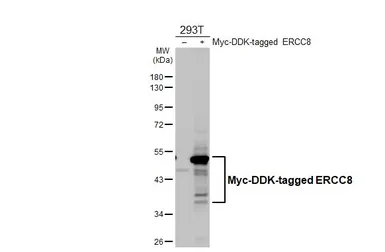 Anti-ERCC8 antibody [HL4475] used in Western Blot (WB). GTX644040