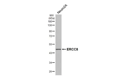 Anti-ERCC8 antibody [HL4475] used in Western Blot (WB). GTX644040