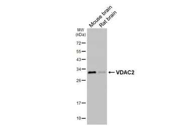 Anti-VDAC2 antibody [HL4477] used in Western Blot (WB). GTX644044