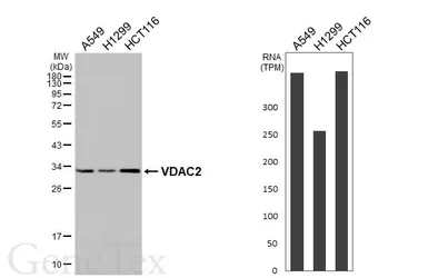 Anti-VDAC2 antibody [HL4477] used in Western Blot (WB). GTX644044