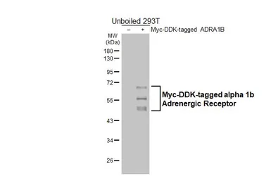 Anti-alpha 1b Adrenergic Receptor antibody [HL4478] used in Western Blot (WB). GTX644045