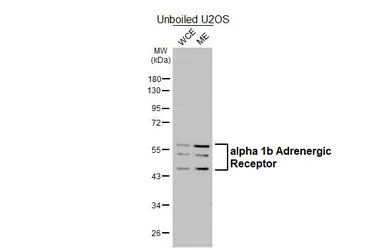 Anti-alpha 1b Adrenergic Receptor antibody [HL4478] used in Western Blot (WB). GTX644045