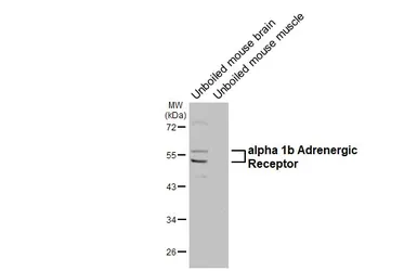Anti-alpha 1b Adrenergic Receptor antibody [HL4478] used in Western Blot (WB). GTX644045
