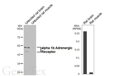 Anti-alpha 1b Adrenergic Receptor antibody [HL4478] used in Western Blot (WB). GTX644045