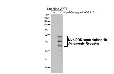Anti-alpha 1b Adrenergic Receptor antibody [HL4479] used in Western Blot (WB). GTX644046