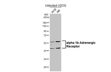 Anti-alpha 1b Adrenergic Receptor antibody [HL4479] used in Western Blot (WB). GTX644046
