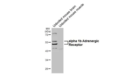 Anti-alpha 1b Adrenergic Receptor antibody [HL4479] used in Western Blot (WB). GTX644046