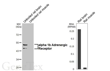 Anti-alpha 1b Adrenergic Receptor antibody [HL4479] used in Western Blot (WB). GTX644046