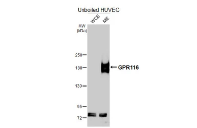 Anti-GPR116 antibody [HL4482] used in Western Blot (WB). GTX644049
