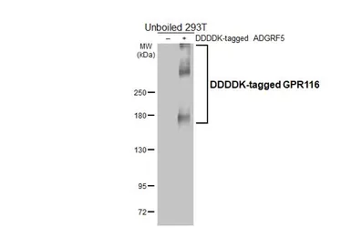 Anti-GPR116 antibody [HL4482] used in Western Blot (WB). GTX644049