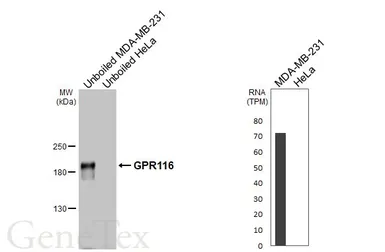 Anti-GPR116 antibody [HL4482] used in Western Blot (WB). GTX644049