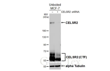 Anti-CELSR2 antibody [HL4484] used in Western Blot (WB). GTX644051