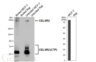 Anti-CELSR2 antibody [HL4484] used in Western Blot (WB). GTX644051