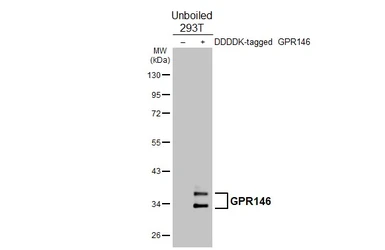 Anti-GPR146 antibody [HL4489] used in Western Blot (WB). GTX644056