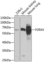 Anti-P2X4 antibody used in Western Blot (WB). GTX64406