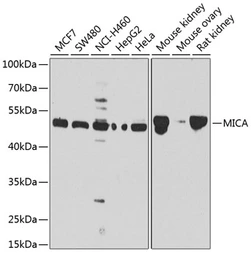 Anti-MICA antibody used in Western Blot (WB). GTX64407
