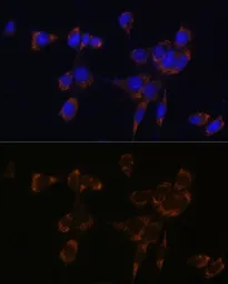 Anti-Perforin antibody used in Immunocytochemistry/ Immunofluorescence (ICC/IF). GTX64408