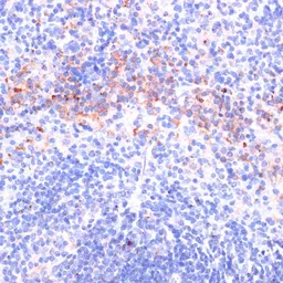 Anti-Perforin antibody used in IHC (Paraffin sections) (IHC-P). GTX64408
