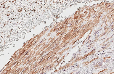 Anti-alpha 2b Adrenergic Receptor antibody [HL4510] used in IHC (Paraffin sections) (IHC-P). GTX644080