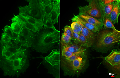 Anti-alpha 2b Adrenergic Receptor antibody [HL4510] used in Immunocytochemistry/ Immunofluorescence (ICC/IF). GTX644080