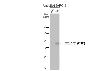 Anti-CELSR1 antibody [HL4515] used in Western Blot (WB). GTX644085