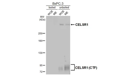 Anti-CELSR1 antibody [HL4515] used in Western Blot (WB). GTX644085