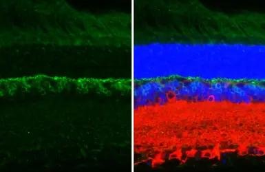 Anti-mGluR6 antibody [HL4516] used in IHC (Paraffin sections) (IHC-P). GTX644086