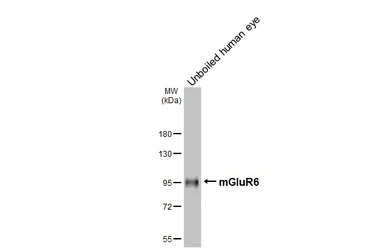 Anti-mGluR6 antibody [HL4518] used in Western Blot (WB). GTX644088